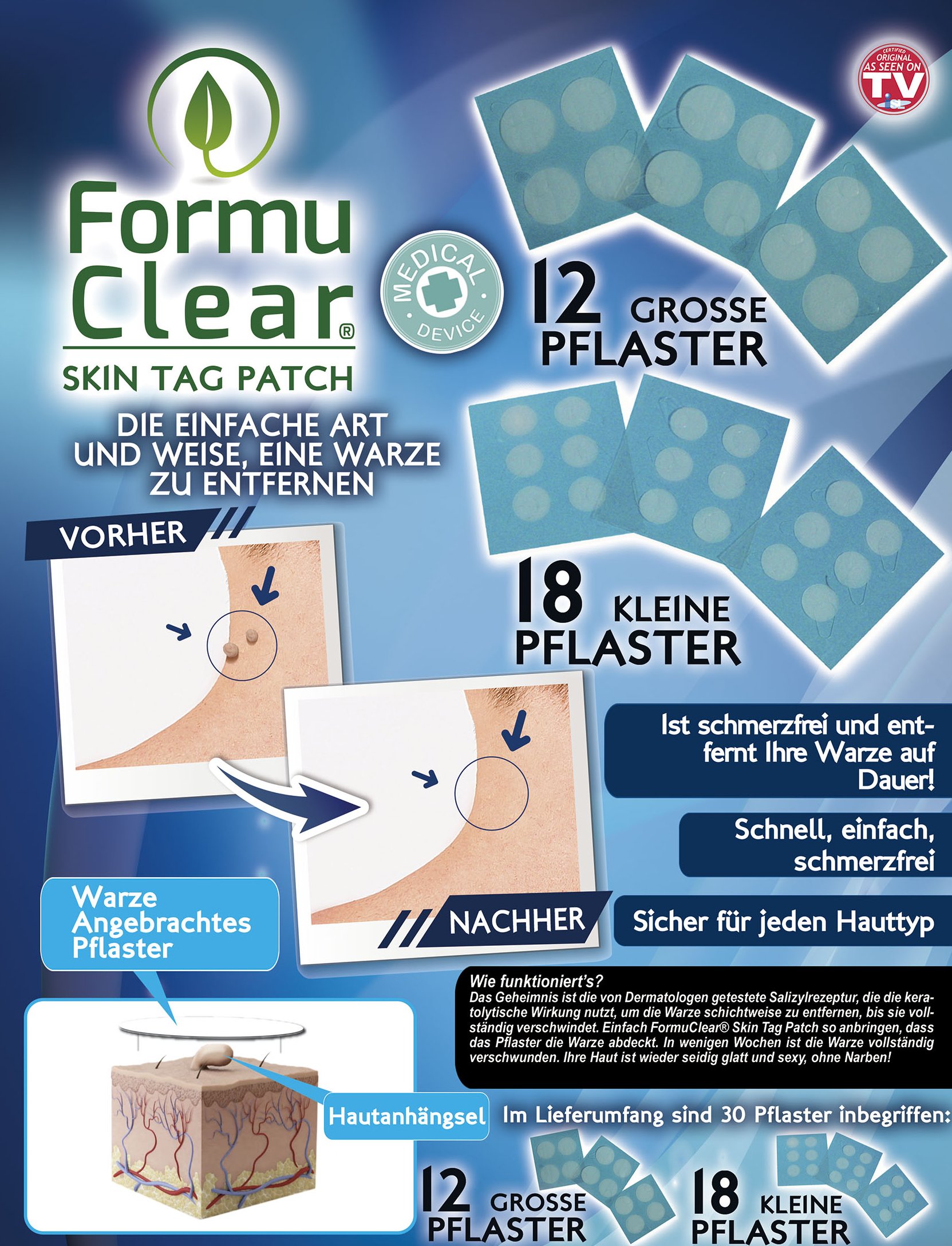 Formu Clear Skin Tag Patch - assortment of 30 pieces - wart plasters